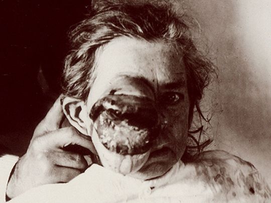 Burns_Archive_021_540x405.jpg