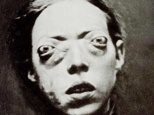 Burns_Archive_028_540x405.jpg