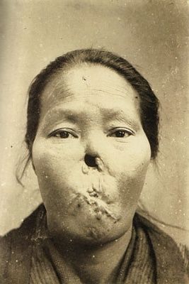 facial-deformity-04.jpg