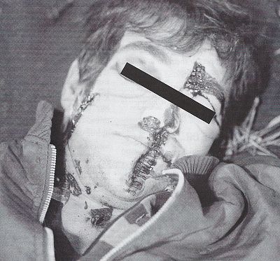 victims-head.jpg