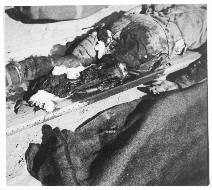unidentified_soldier_with_one_leg_blown_off_by_a_bomb_el_alamein_egypt._1942_photograph_taken_by.jpg