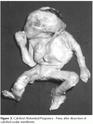 abnormal-preg.gif
