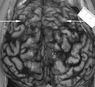 brain.jpg