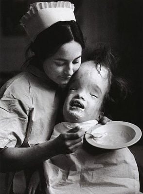 nurse-deformed-kid.jpg