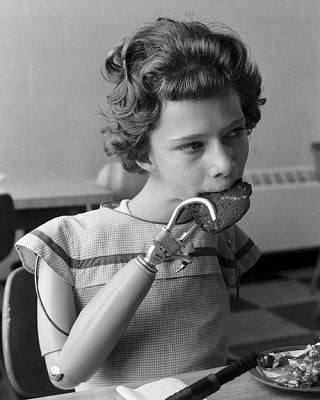girl-prostetic-arm.jpg