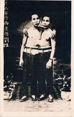conjoined.jpg