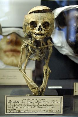 skeleton-small-child.jpg