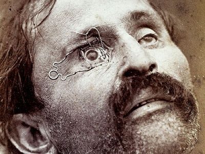 eye-surgery.jpg