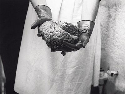 brain.jpg