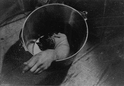 amputated-arm-civil-war-field-hospital.jpg