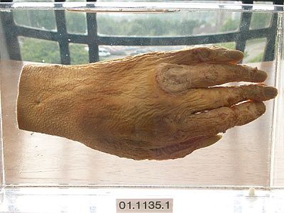 hall-edwards-hand-003.jpg