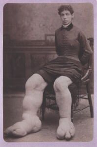 fanny_mills1.jpg