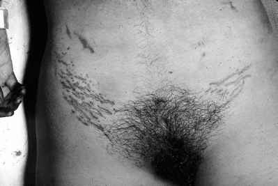 striae.jpg