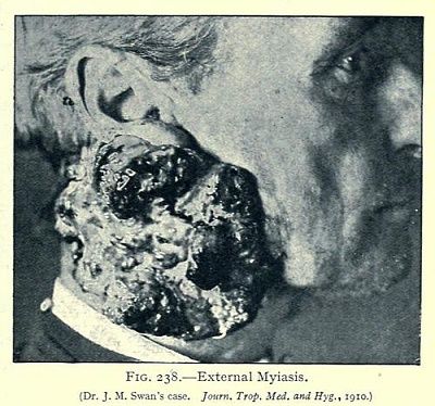 myiasis.jpg