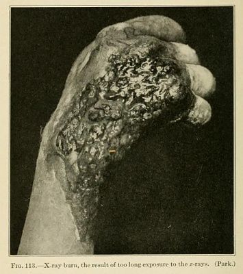 xray.jpg
