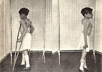 spine-20deformity.jpg