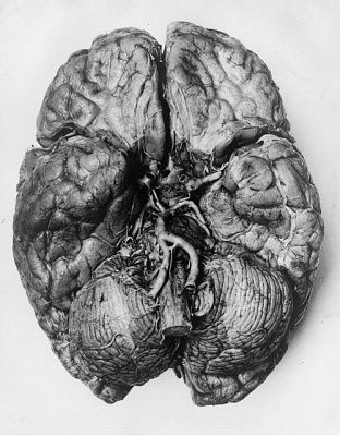 brain.jpg