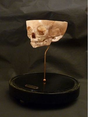 antique-20medical-20foetal-20skull-20showing-20ear-20bones-20-283-29.jpg