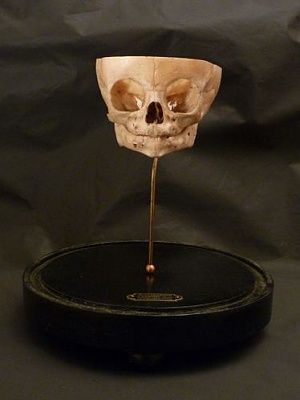 antique-20medical-20foetal-20skull-20showing-20ear-20bones-20-282-29.jpg