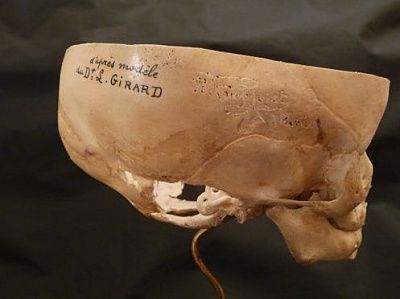antique-20medical-20foetal-20skull-20showing-20ear-20bones-20-284-29.jpg