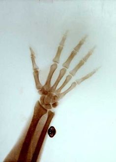 xray.jpg