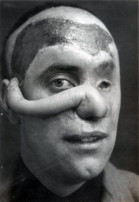 ww1_plastic_surgery_021.jpg