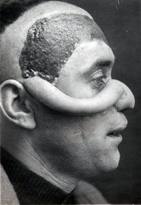 ww1_plastic_surgery_045.jpg