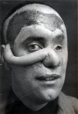 ww1_plastic_surgery_046.jpg