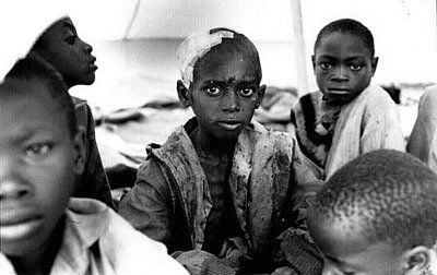 rwanda-child-wounded.jpg
