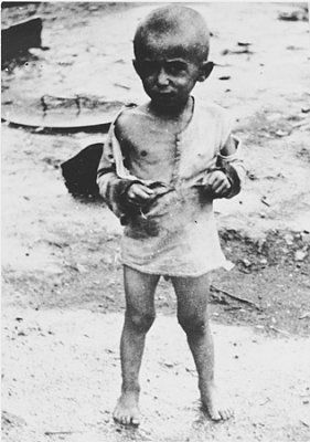 emaciated-20child-20at-20the-20jasenovac-20camp.jpg