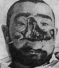 Name:  dentdarcissacp47.jpg
Views: 249
Size:  6.9 KB