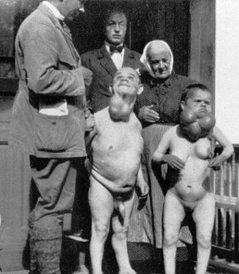 figure-4-cretins-sweden-normal-sized-171-cm-mother-after-hojer.jpg
