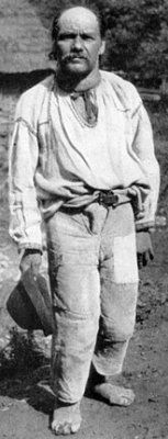 figure-6-cretin-goitre-50-years-old-carpathians-after-d-adaroenko.jpg