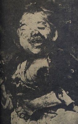 tumblr_lpxgqy2wk41r0ac22o1_400-20to-20this-20mutilated-20croatian-20child-20from-20kosutice-2c-2.jpg