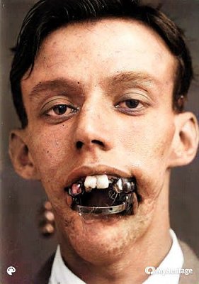 jaws.jpg-5b4-5d.jpg