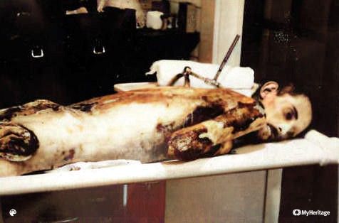 246489d1297617699-1930s-man-autopsy_post_mortem_1930s_man_02001-Colorized.jpg
