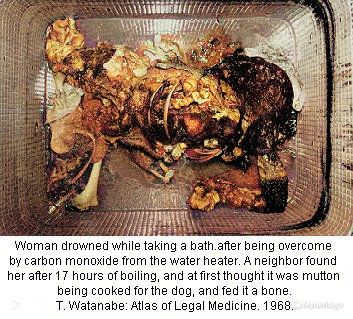 281796d1308417105-accidental-deaths-tcfor0541-Colorized.jpg