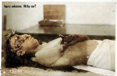 903606d1583601365-vintage-morgue-photos-mpd8-20-20unknown1-colorized.jpg