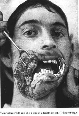 ww1-20injury-204.jpg