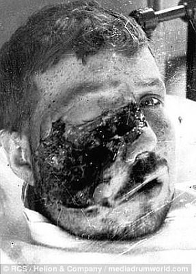 ww-201-20injury-207.jpg