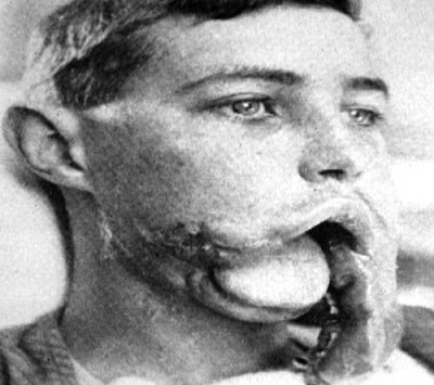 ww-201-20injury-202.jpg