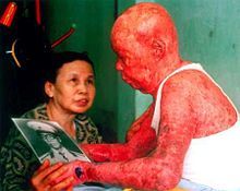 agentorange2.jpg