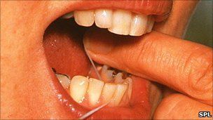 Name: _53863023_m7800052-young_woman_using_dental_floss-spl.jpg
Views: 256
Size: 13.2 KB