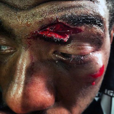 fight-night-59-cut.jpg