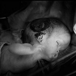 child-victim.jpg