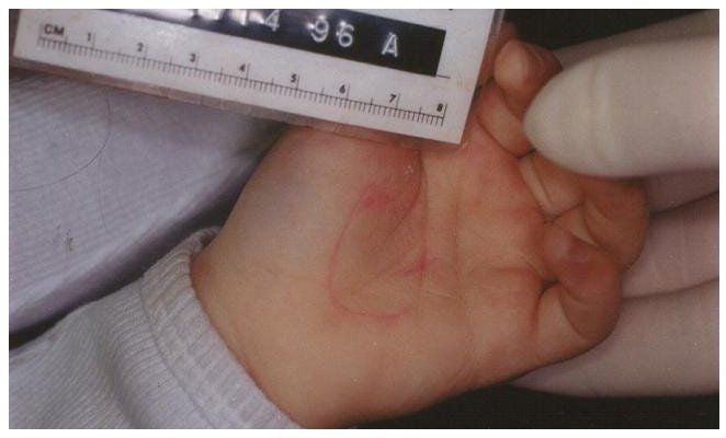 HandClear.jpg