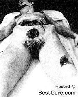 elizabeth-short-autopsy-02.jpg