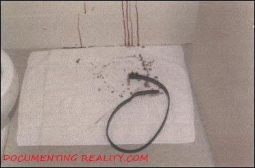 Name:  LemmePhoto_BloodOnTowel.jpg
Views: 13592
Size:  27.2 KB