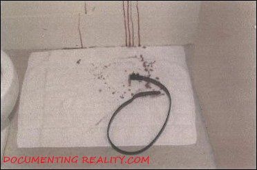 Name:  LemmePhoto_BloodOnTowel.jpg
Views: 13610
Size:  27.2 KB