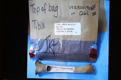 ht-top_tibia_ll_110614_ssh.jpg